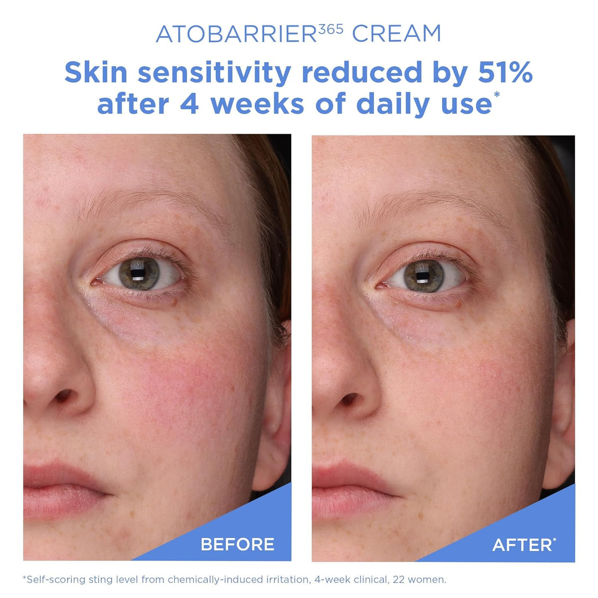 Intensive Ceramide Barrier Recovery Cream